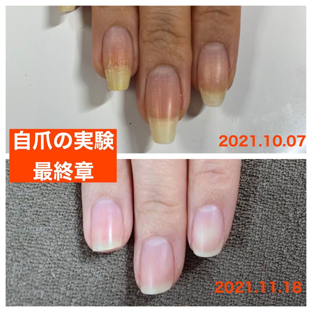 爪健美道 ネイルインナースキンケア/爪健美道 自爪ネイルケアライン/ネイルオイル・トリートメントを使ったクチコミ(2枚目)