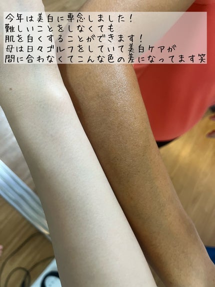 100%完全遮光 日傘/Rose Blanc/日傘を使ったクチコミ(2枚目)