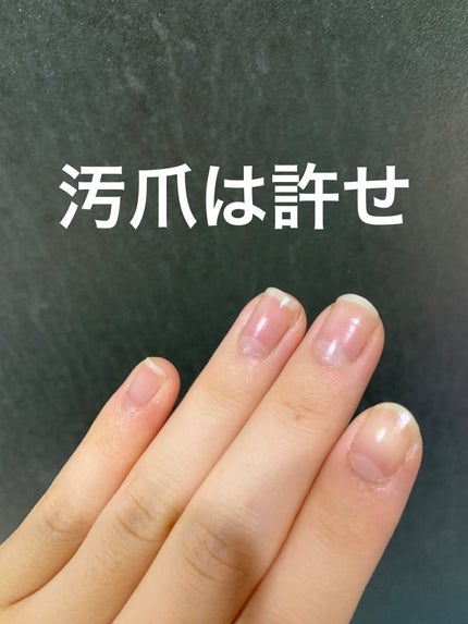 エテュセ クイックケアコート/ettusais/ネイルオイル・トリートメントを使ったクチコミ(3枚目)