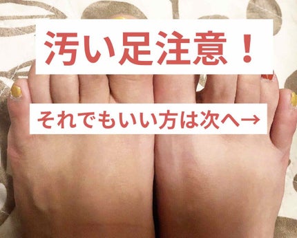 カラフルネイルズ/キャンメイク/マニキュアを使ったクチコミ(2枚目)