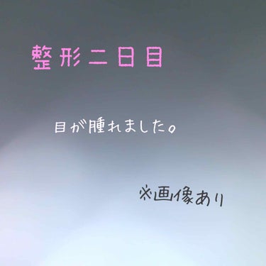 昨日SBCでフォーエバー二重術を受けてきました。

昨日の夜から腫れ始め、まるで蛙みたいな目になりました。これはお外に出られませんね。
後何日で腫れが引くのかな〜って心配です。

ケータイを使うのを控え