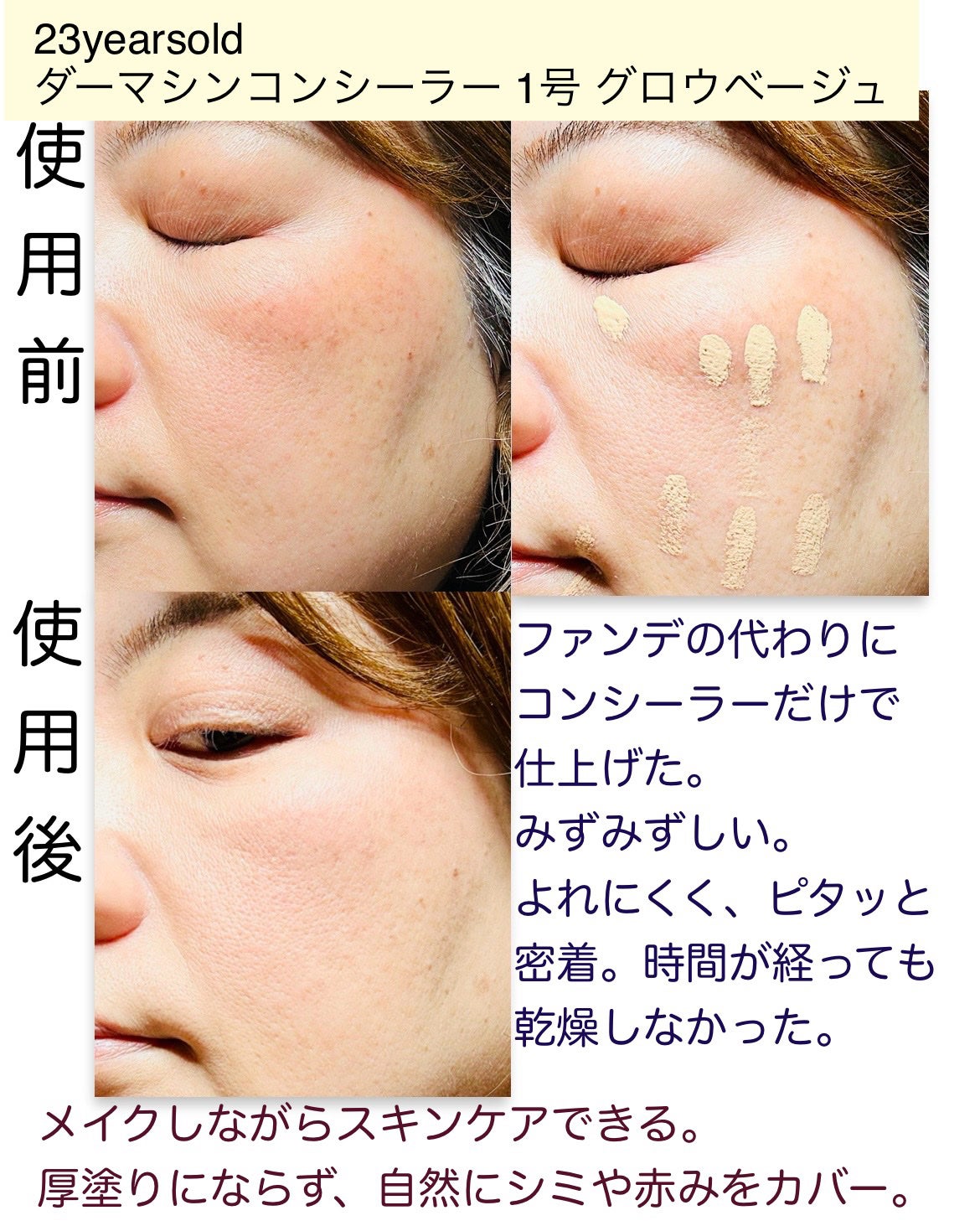 ダーマシンコンシーラー/23years old/リキッドコンシーラーを使ったクチコミ(3枚目)
