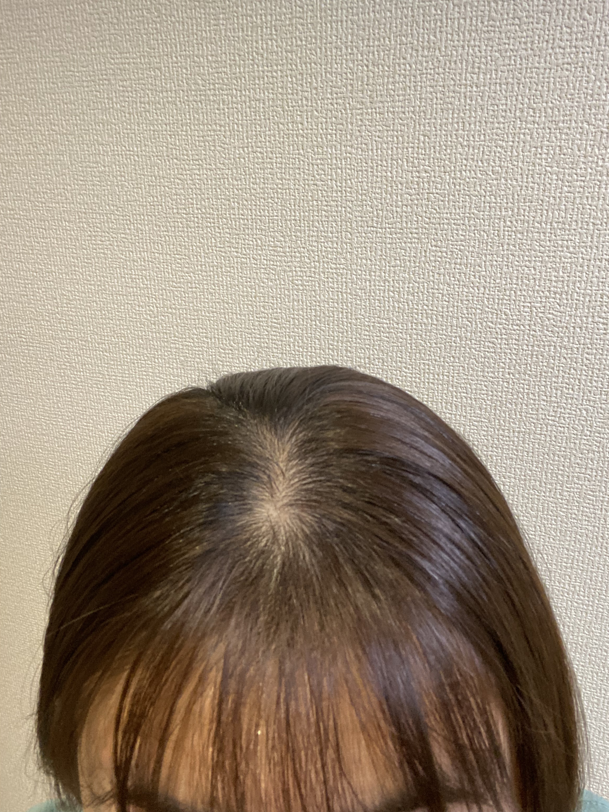 リラクシングマッサージブラシ/エトヴォス/スカルプブラシを使ったクチコミ（2枚目）