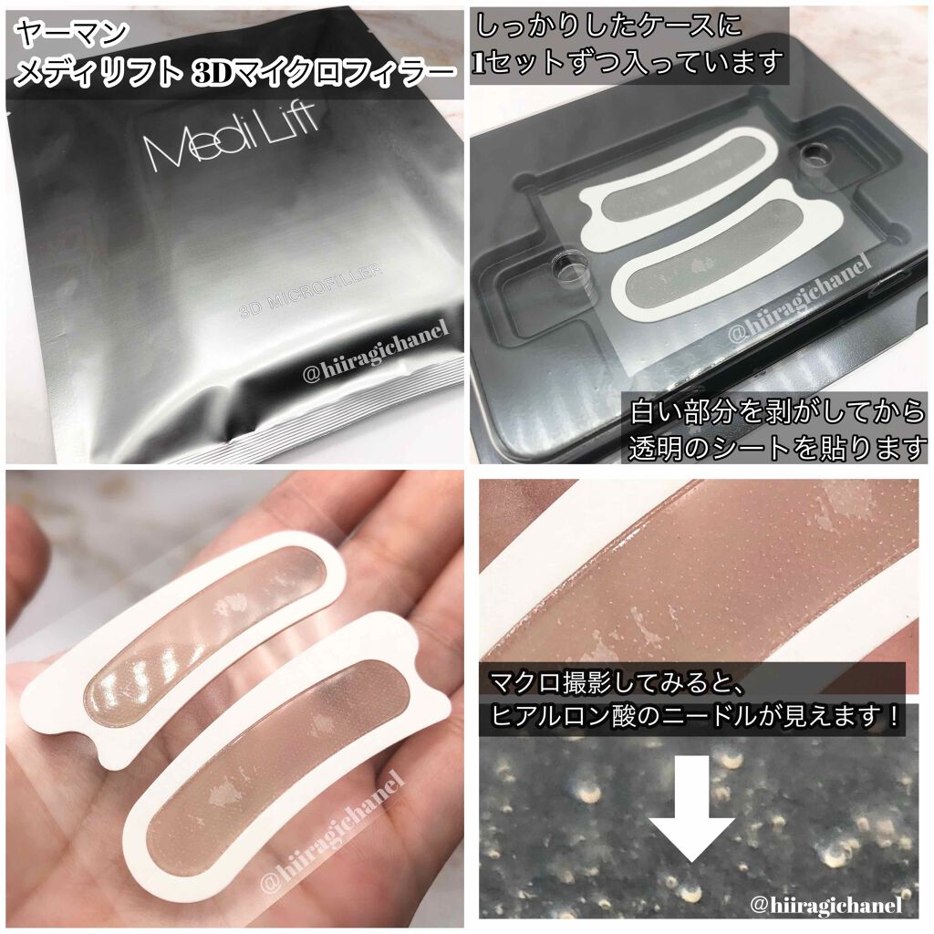 メディリフト 3Dマイクロフィラー(口元用)/YA-MAN TOKYO JAPAN/シートマスク・パックを使ったクチコミ(2枚目)