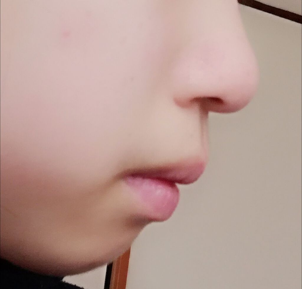 まほ on LIPS 「汚い鼻をお見せしてすみません。自分の結果報告みたいなものです。..」(2枚目)