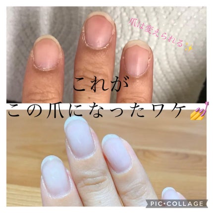 RMK ネイルケア ジェルオイル N/RMK/ネイルオイル・トリートメントを使ったクチコミ(1枚目)