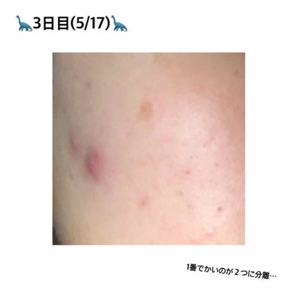 白潤 薬用美白乳液/肌ラボ/乳液を使ったクチコミ(3枚目)