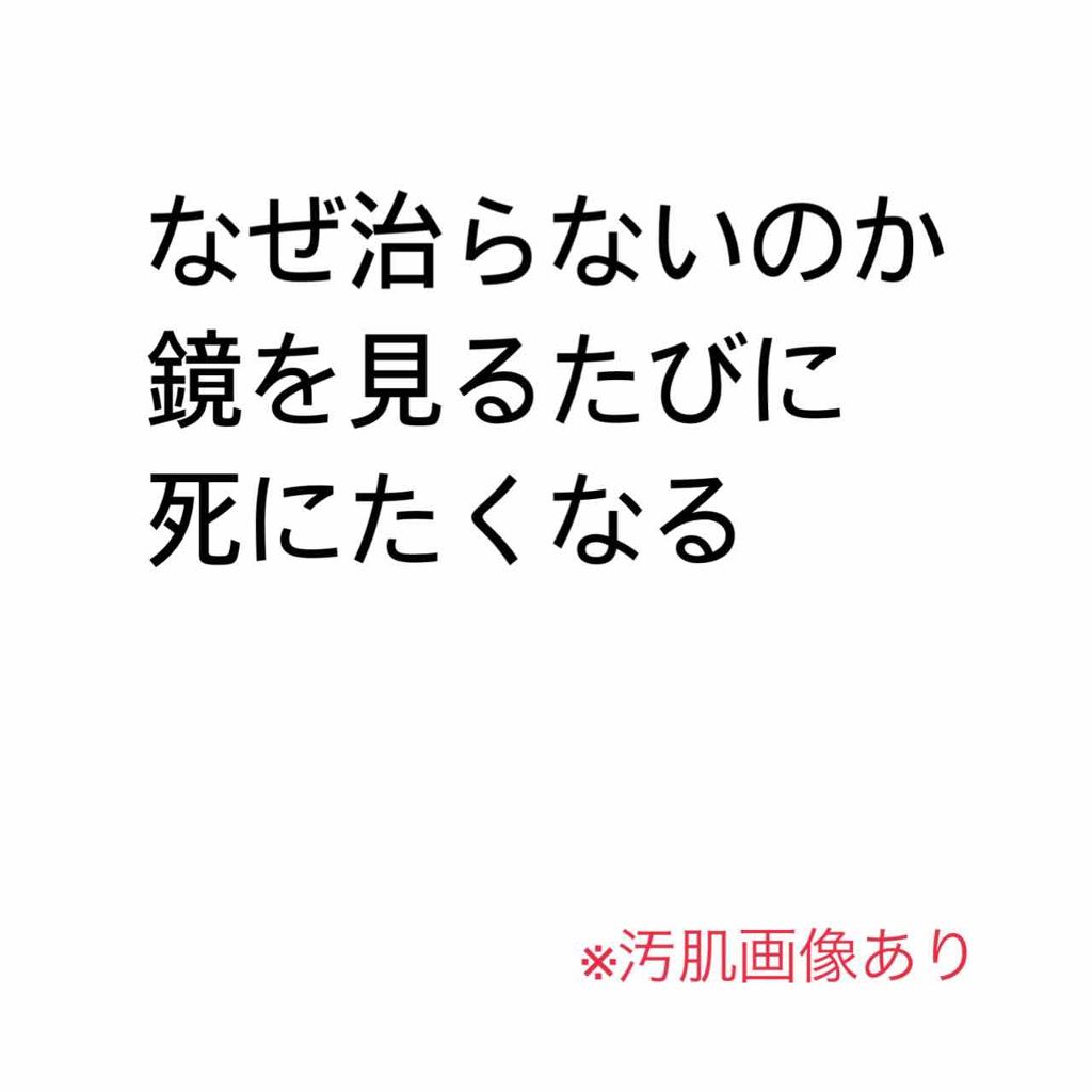 薬用ローション（とてもしっとり）/IHADA/化粧水を使ったクチコミ（1枚目）