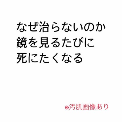 薬用ローション(とてもしっとり)/IHADA/化粧水を使ったクチコミ(1枚目)