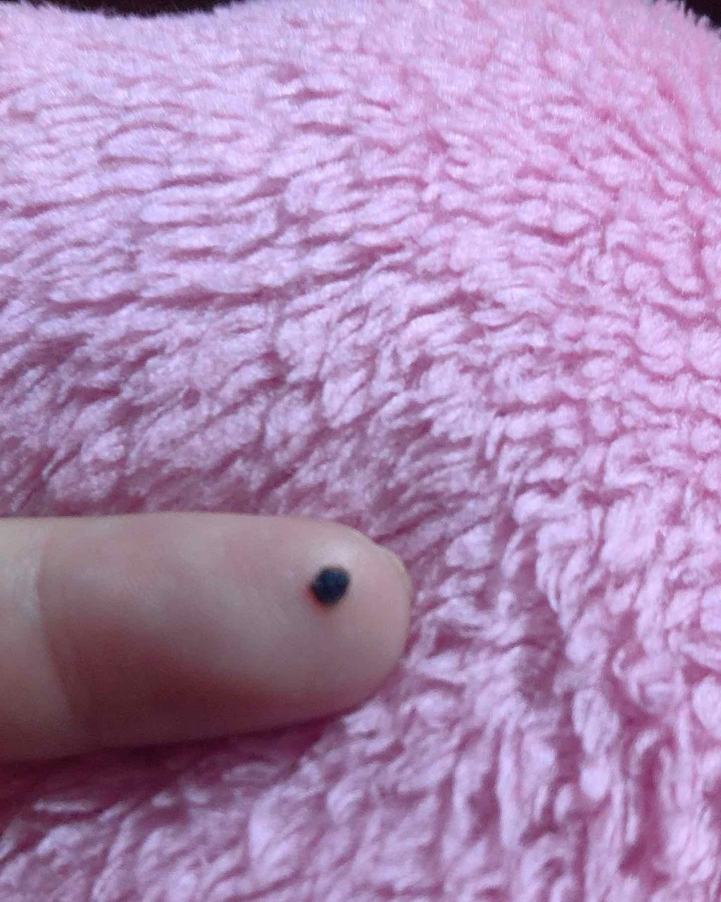 ちょこ on LIPS 「自力で黒子を除去しました😵LIPSに製品情報がなかったのでジャ..」(3枚目)