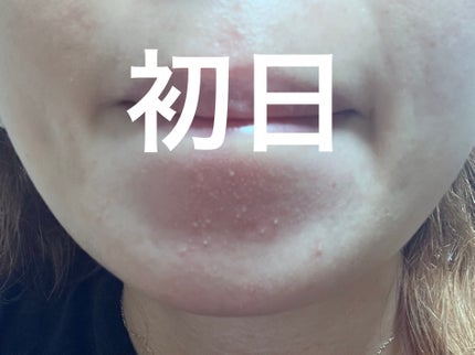 ソフティモ 泡洗顔(セラミド)/ソフティモ/泡洗顔を使ったクチコミ(2枚目)