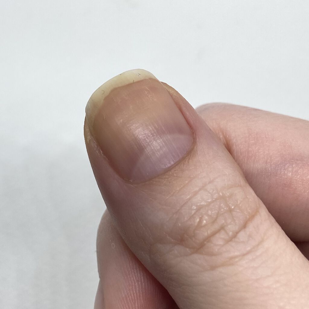 ネイルサポート Na/ネイルネイル/ネイルトップコートを使ったクチコミ（3枚目）