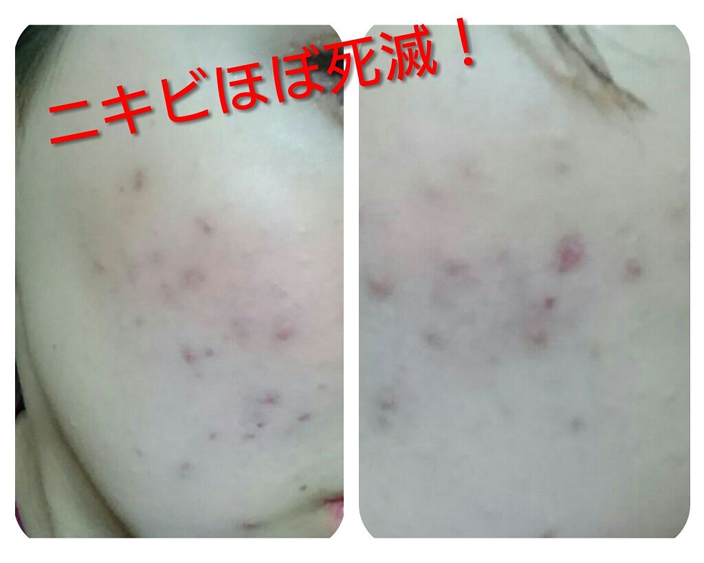 ハトムギ保湿ジェル(ナチュリエ スキンコンディショニングジェル)/ナチュリエ/美容液を使ったクチコミ（2枚目）