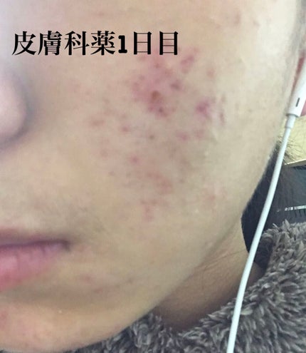 を使ったクチコミ(2枚目)