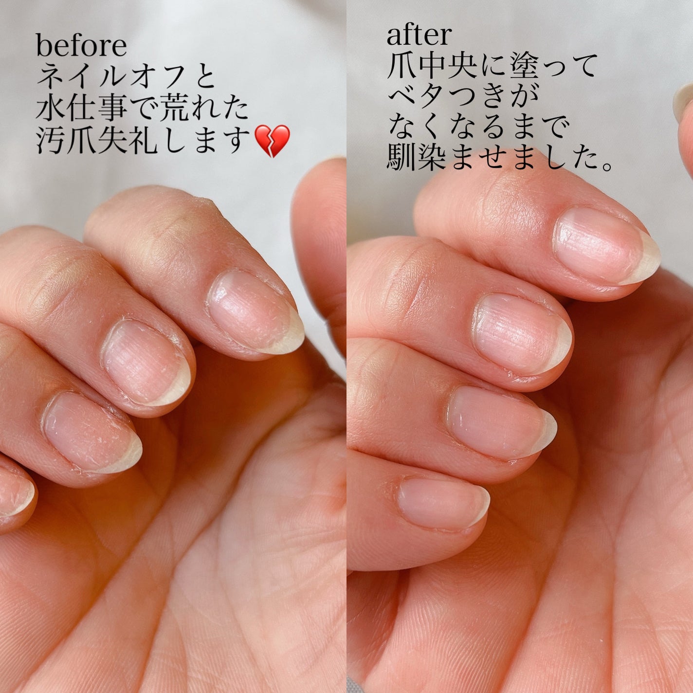 mioðð¿ïž on LIPS ãSHEINã§è³Œå
¥ãããã©ã€ãã©ã¯ãŒå
¥ããã€ã«ãªã€ã«ã坿ãéã..ãïŒ5æç®ïŒ