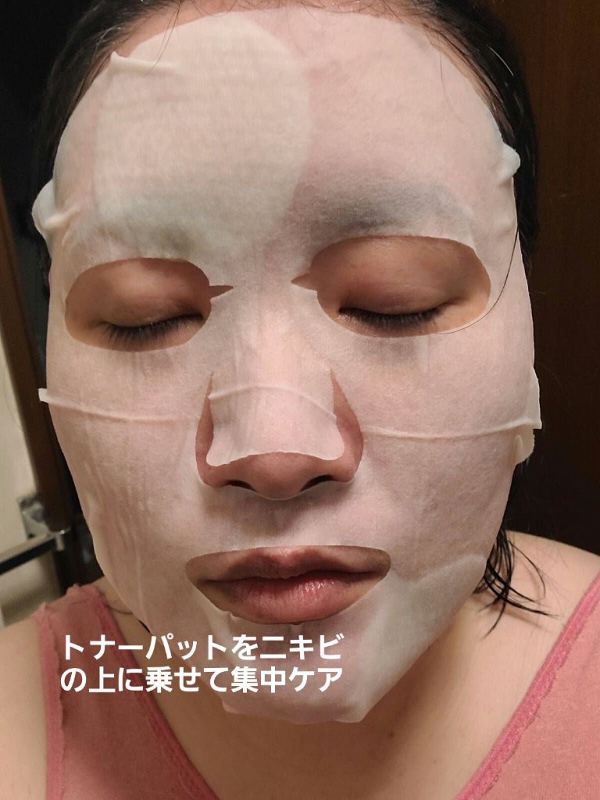 グリーン ダーマCICAビックトナー/ネイチャーリパブリック/化粧水を使ったクチコミ(2枚目)