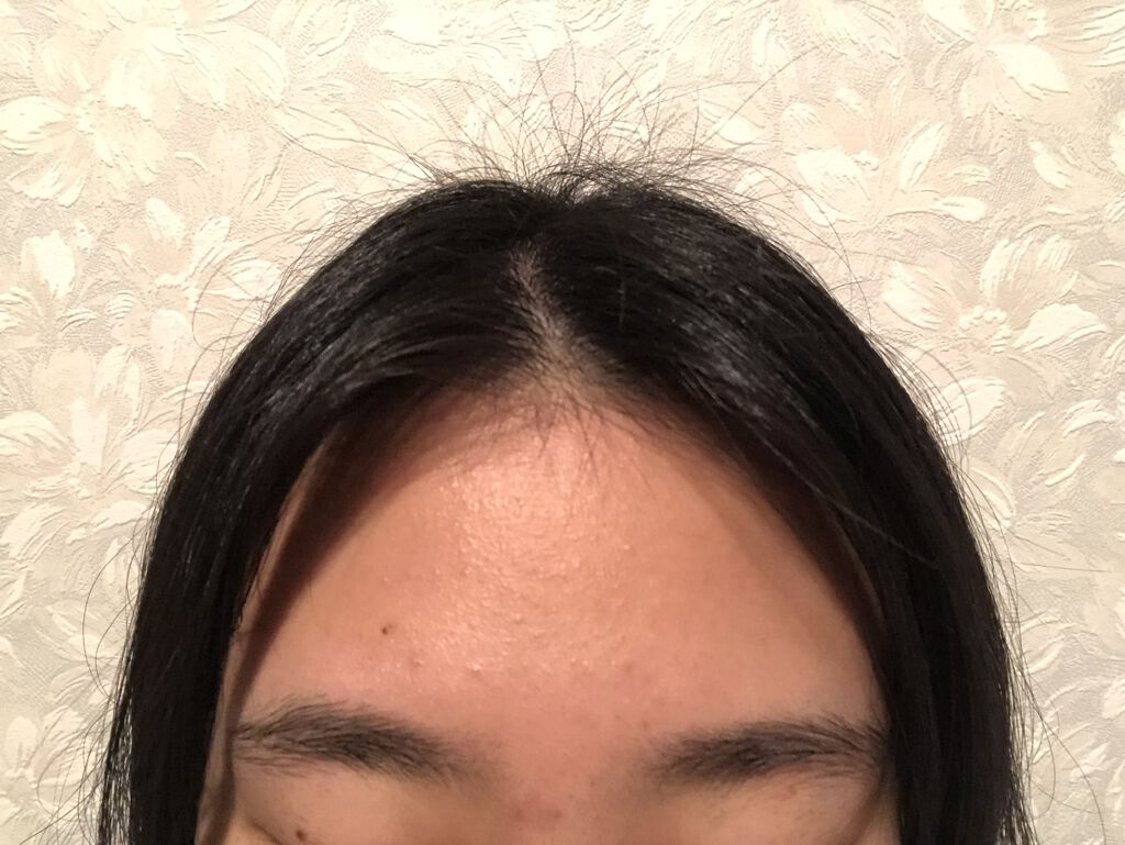 艶肌ドロップ/ラッシュ/美容液を使ったクチコミ（2枚目）