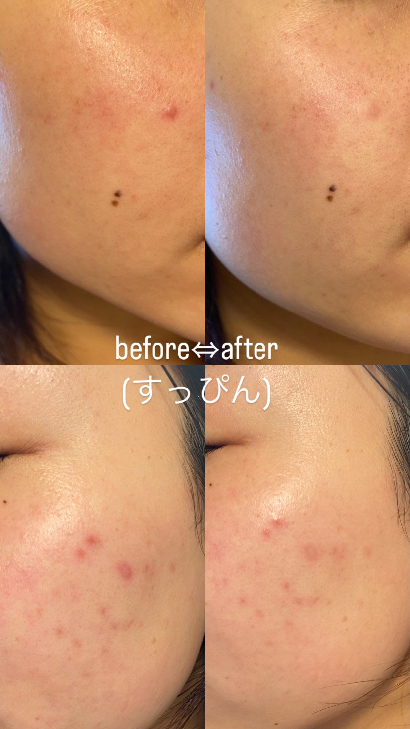 1/3 コットンパッド/Pyunkang Yul/コットンを使ったクチコミ(3枚目)