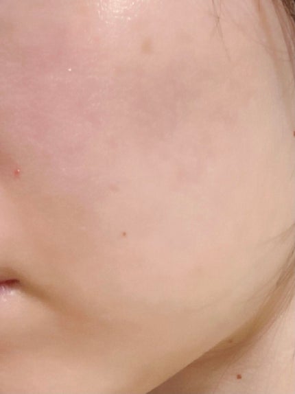 ホワイトアップ ローション(II)/アクアレーベル/化粧水を使ったクチコミ(2枚目)