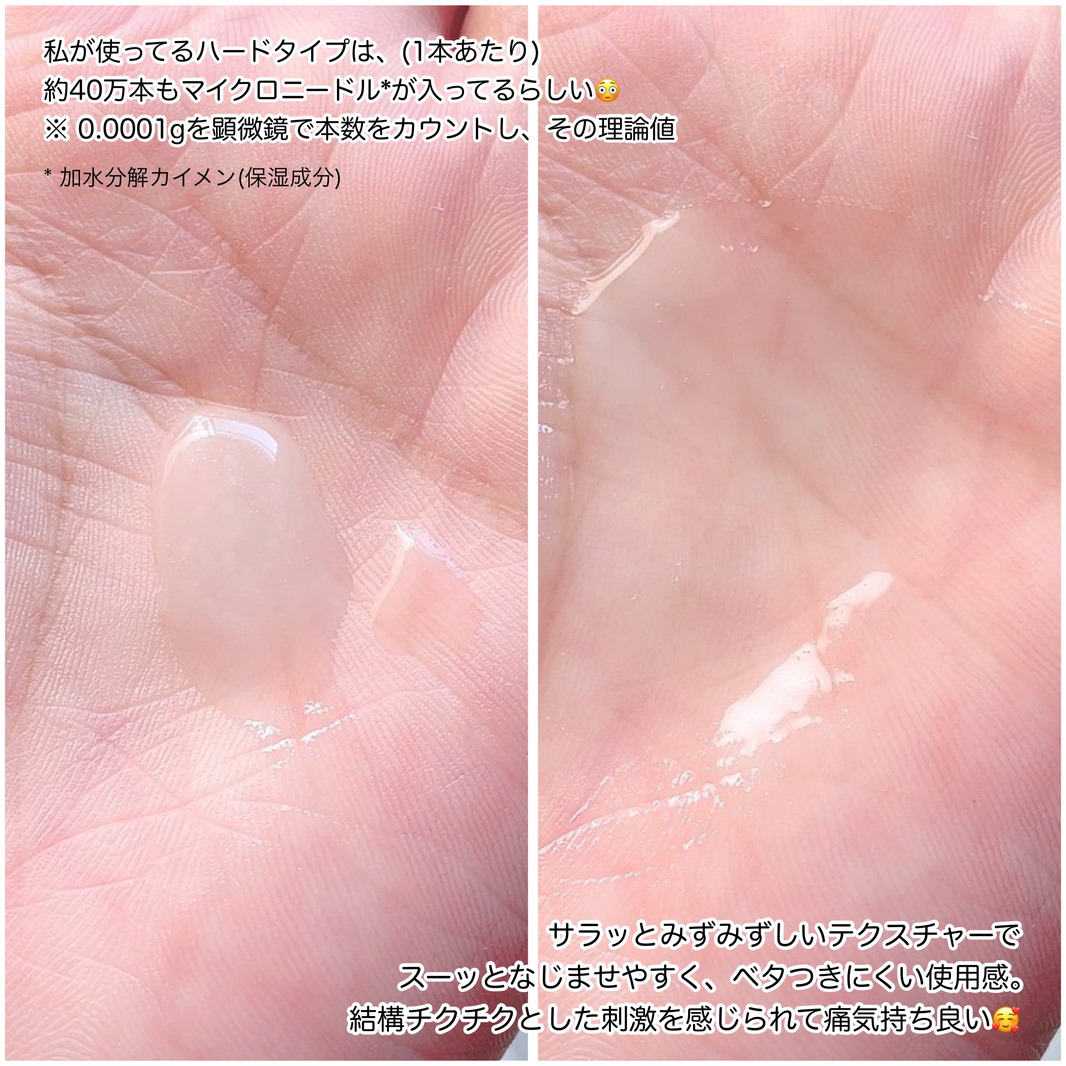 イポケアEX ジェルパッチ/ブレーンコスモス/その他スキンケアを使ったクチコミ（3枚目）