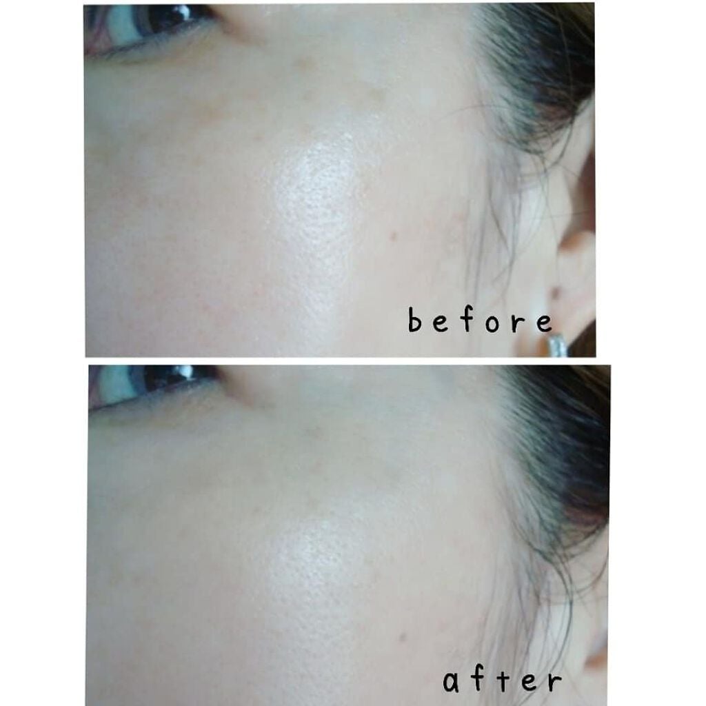 ミネラルカバー薬用美白ファンデセラム/ミリオナ化粧品/美容液を使ったクチコミ(4枚目)