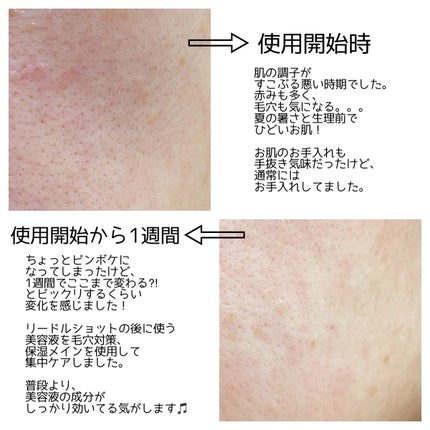 CICA UVトーンアップベース/VT/化粧下地を使ったクチコミ(3枚目)