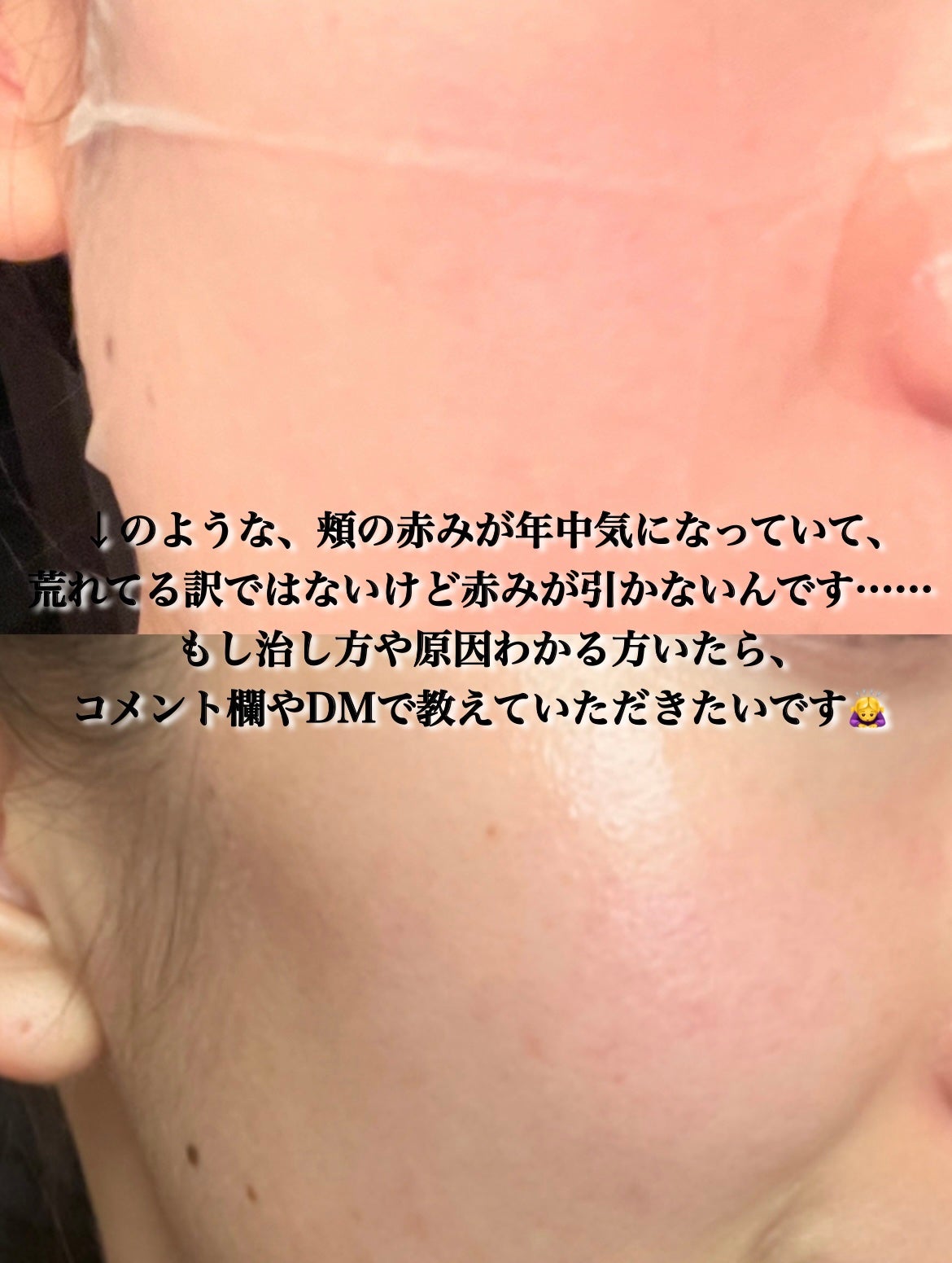 シカレチA セブンデイズマスク/VT/シートマスク・パックを使ったクチコミ(5枚目)