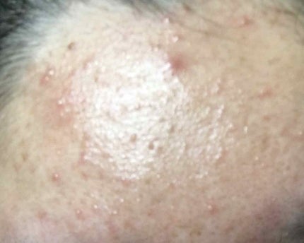 を使ったクチコミ(2枚目)