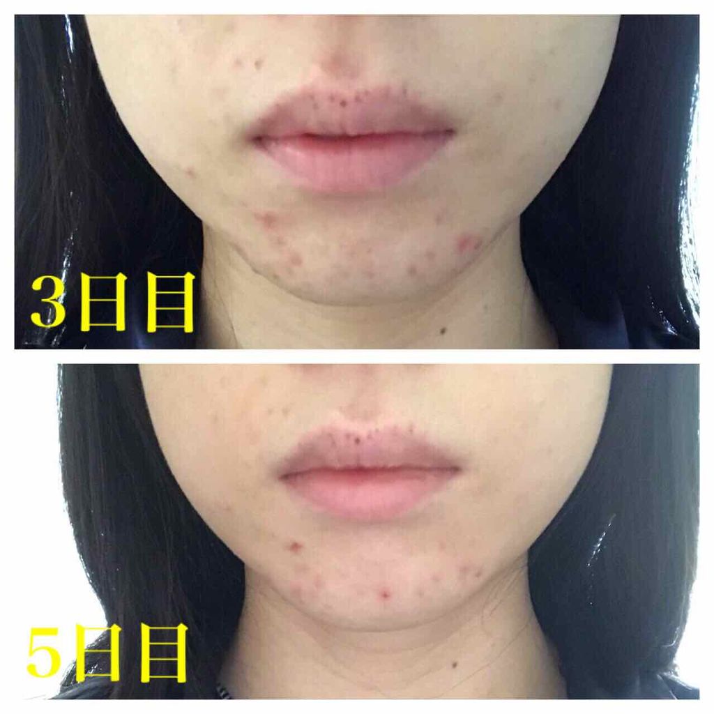 ファイバーフォーム/ルナメアAC/洗顔フォームを使ったクチコミ(3枚目)