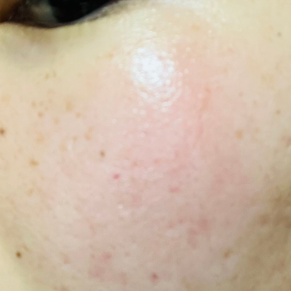 ブースト ポンパー X/アーレス/美容液を使ったクチコミ(5枚目)