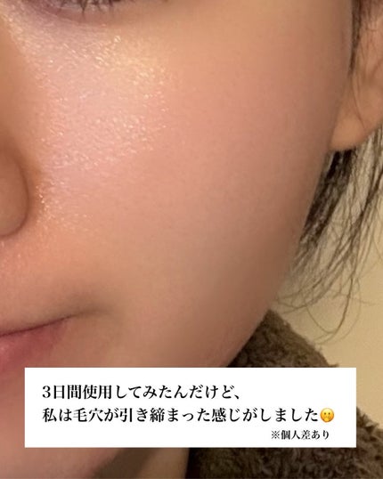 ジンクテカBセラム/BRING GREEN/美容液を使ったクチコミ(4枚目)