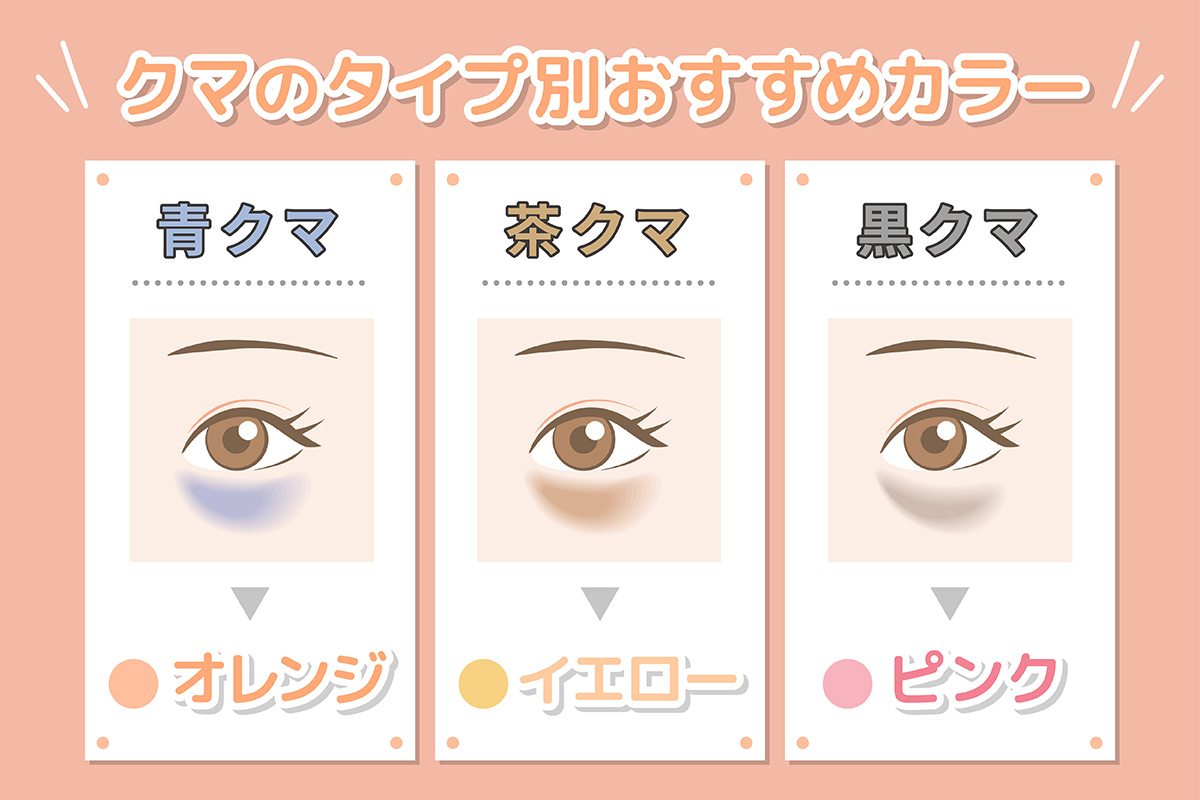クマのタイプ別おすすめカラー。青クマならオレンジ・茶クマならイエロー・黒クマならピンクがおすすめ。