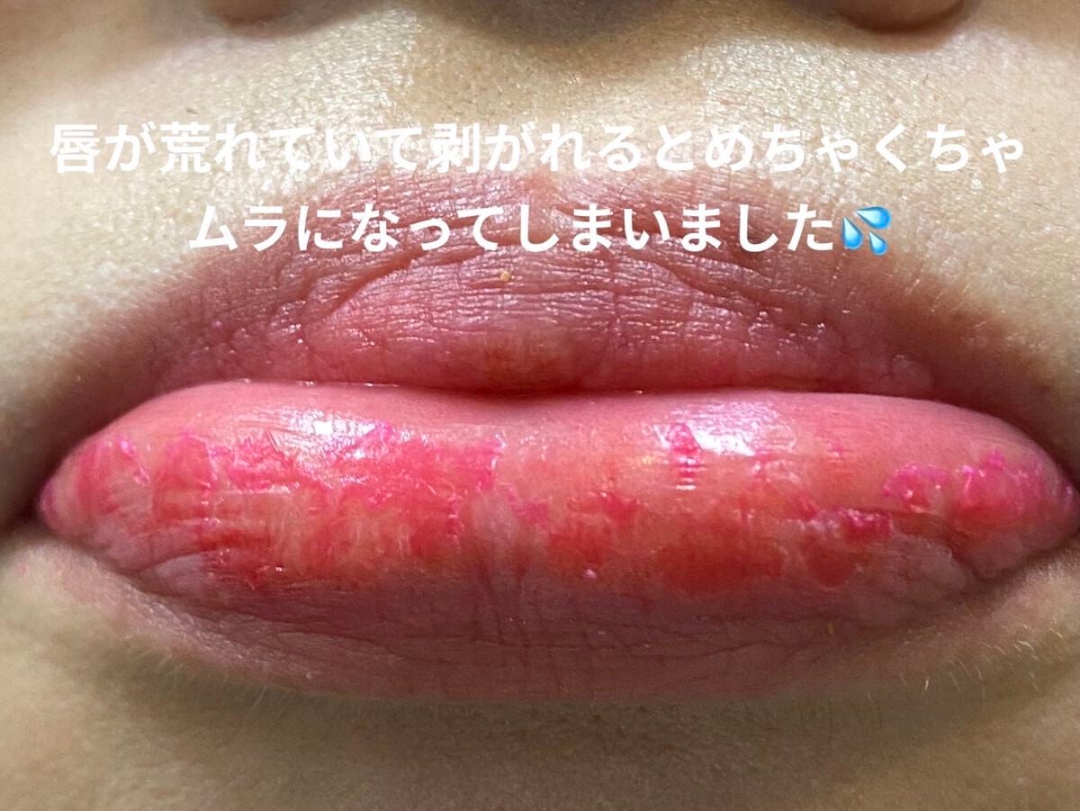 Soak Tattoo Tint/フォレンコス/リップグロスを使ったクチコミ(5枚目)