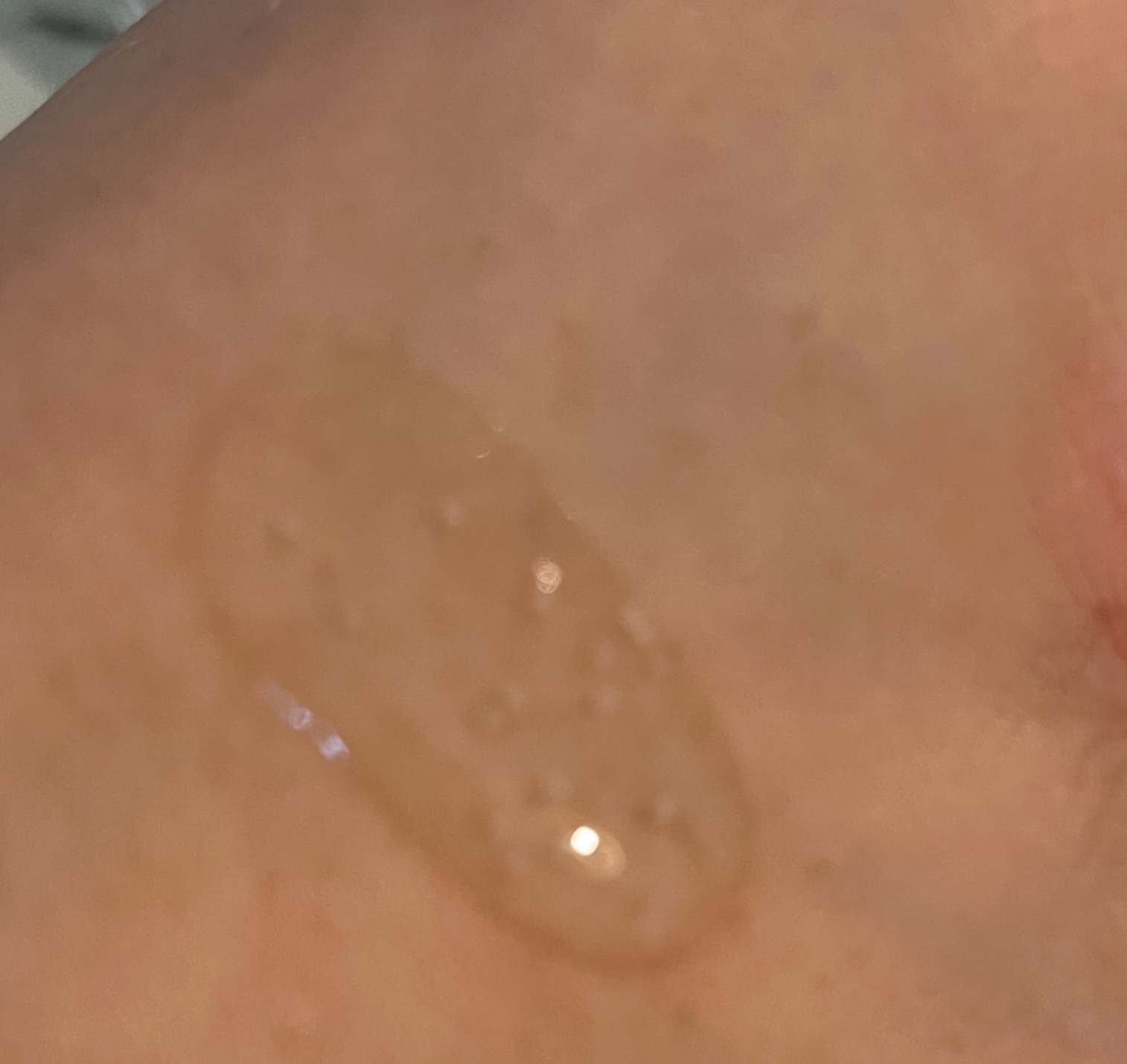 トーンブライトニング カプセルアンプル/SKIN1004/美容液を使ったクチコミ（2枚目）