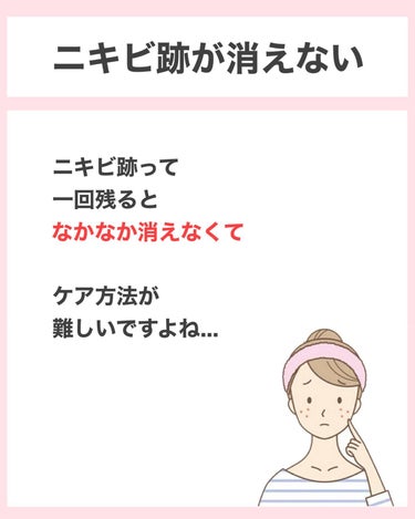 タクミ【ニキビケアサポーター】 on LIPS 「乾燥肌の女子大生に向けてニキビケアを教えているタクミです！今後..」（2枚目）