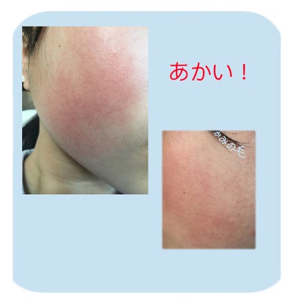 を使ったクチコミ(2枚目)