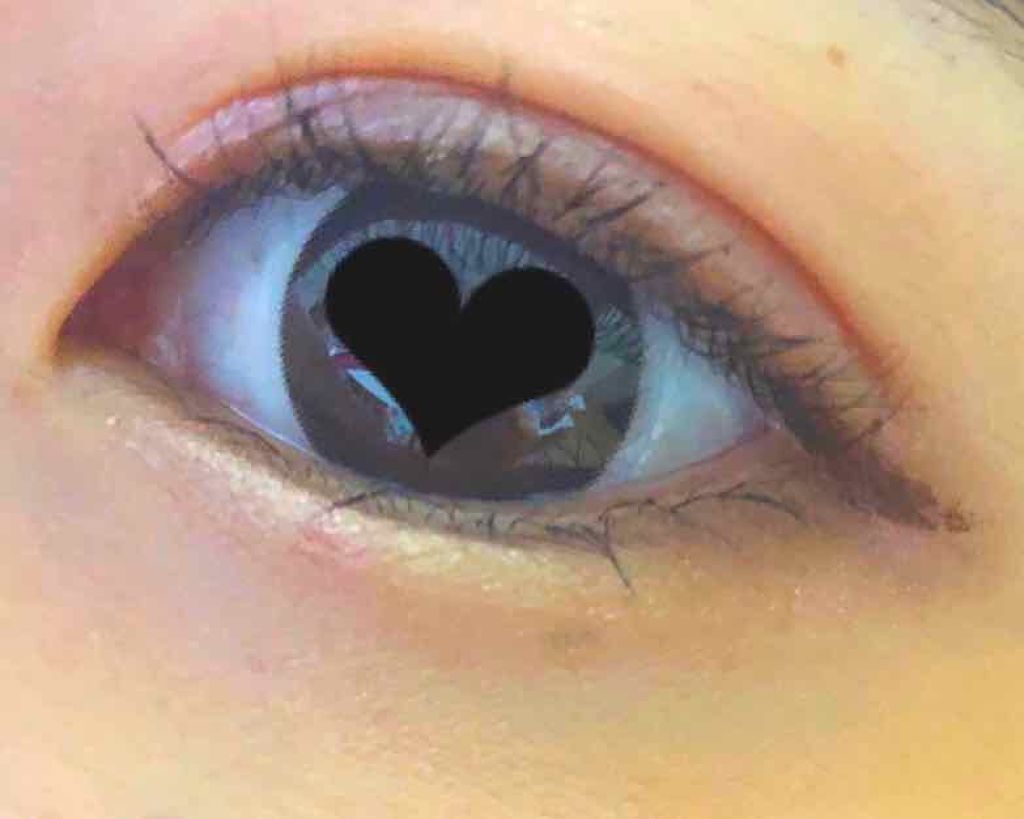 ハイブリッドフィルム/アイトーク/二重まぶた用アイテムを使ったクチコミ（2枚目）