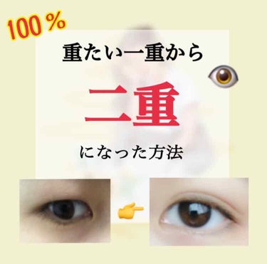 やほやほ！みゆです！

今回は私が一重（奥二重）から二重になった方法を皆さんに紹介していきます！

✄-------------------‐✄
（興味ない人は🐸まで！）

私は5年生くらいから自分の目