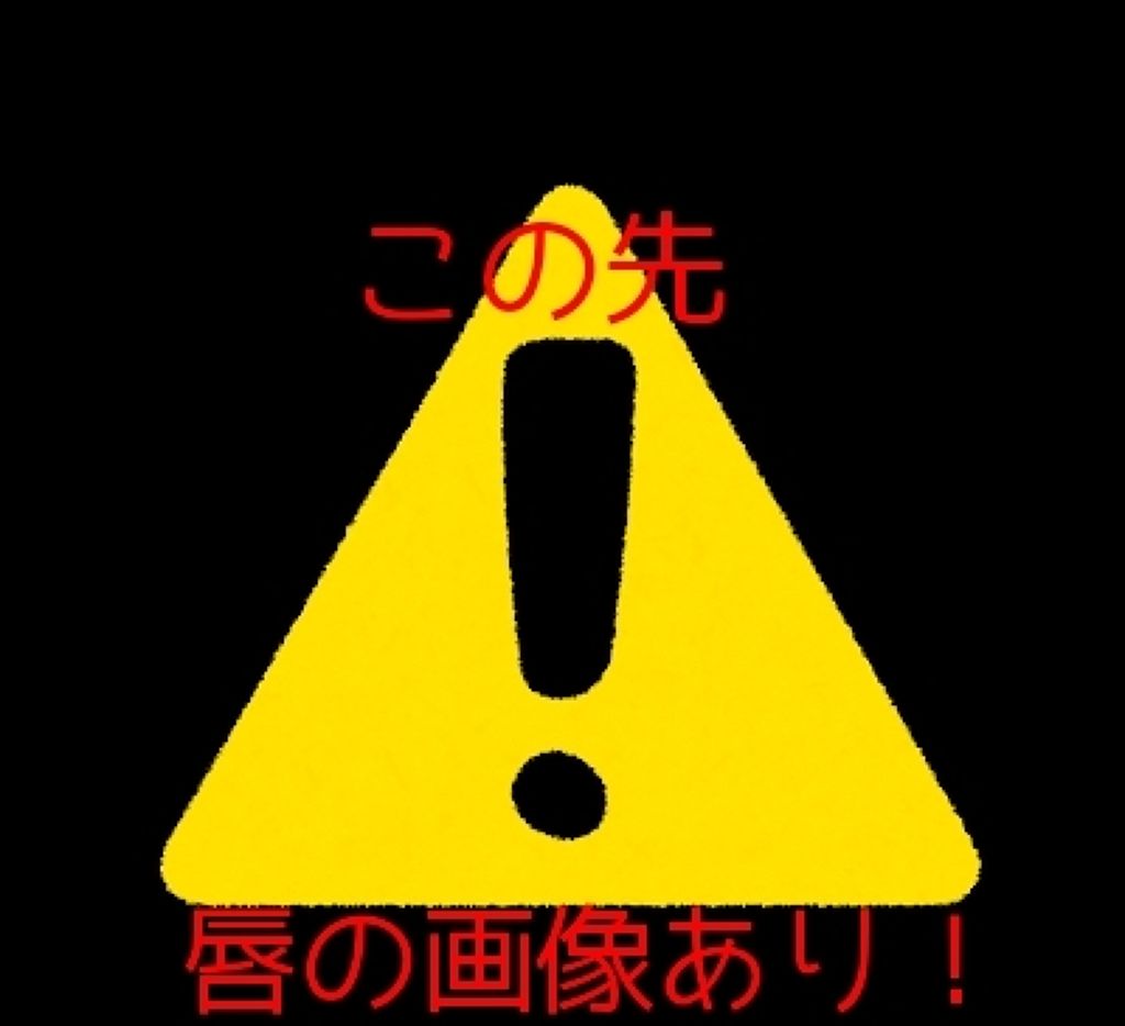 ディアダーリン ウォータージェルティント/ETUDE/リップティントを使ったクチコミ（2枚目）