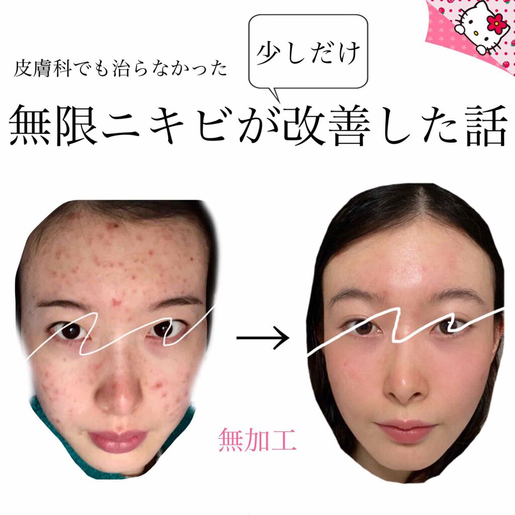 ドライキュア乳液(医薬品)/IHADA/その他を使ったクチコミ(2枚目)