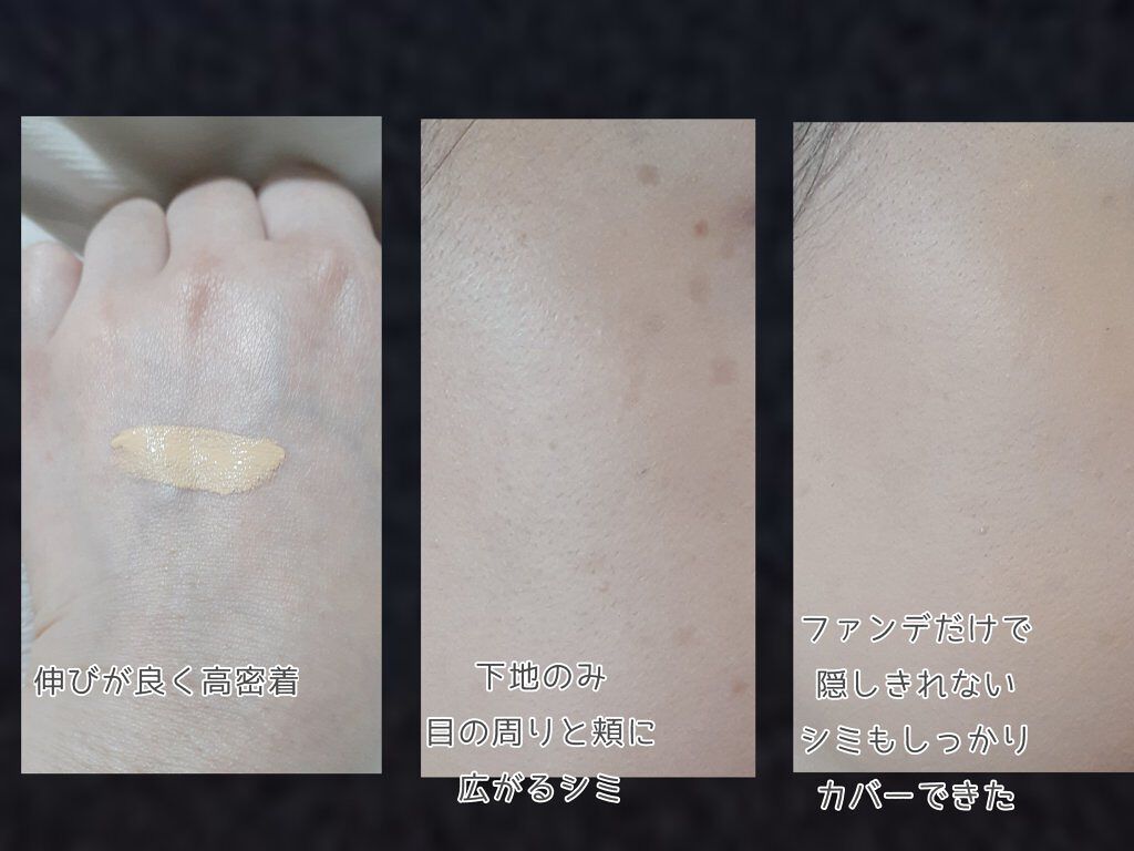 モイストラボ エッセンス薬用美白コンシーラー/Moist Labo/リキッドコンシーラーを使ったクチコミ(3枚目)