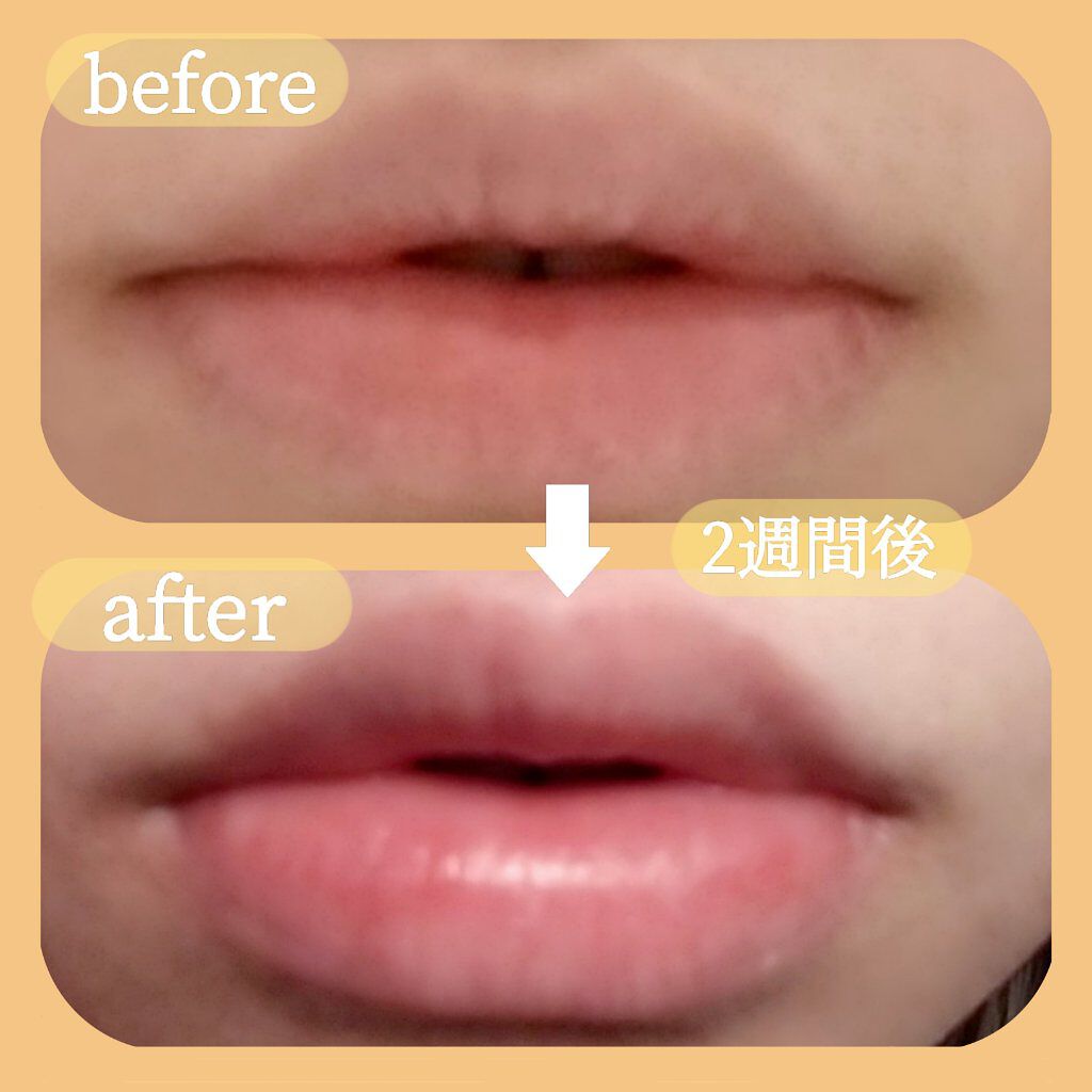 メルティクリームリップ/メンソレータム/リップクリームを使ったクチコミ（2枚目）