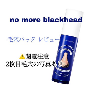 めちゃくちゃ頑固なイチゴ鼻に使ってみた感想です！
下に【使い方】も載せました✍️

┅ ┅ ┅ ┅ ┅ ┅ ┅ ┅ 

【使った商品】
P.Z. SSOC SSOC NO MORE BLACKHEAD
