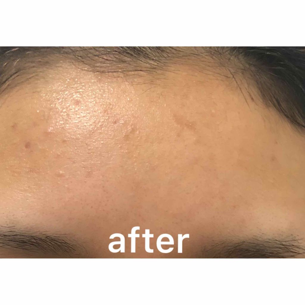 ME レギュラー 3/IPSA/化粧水を使ったクチコミ（3枚目）