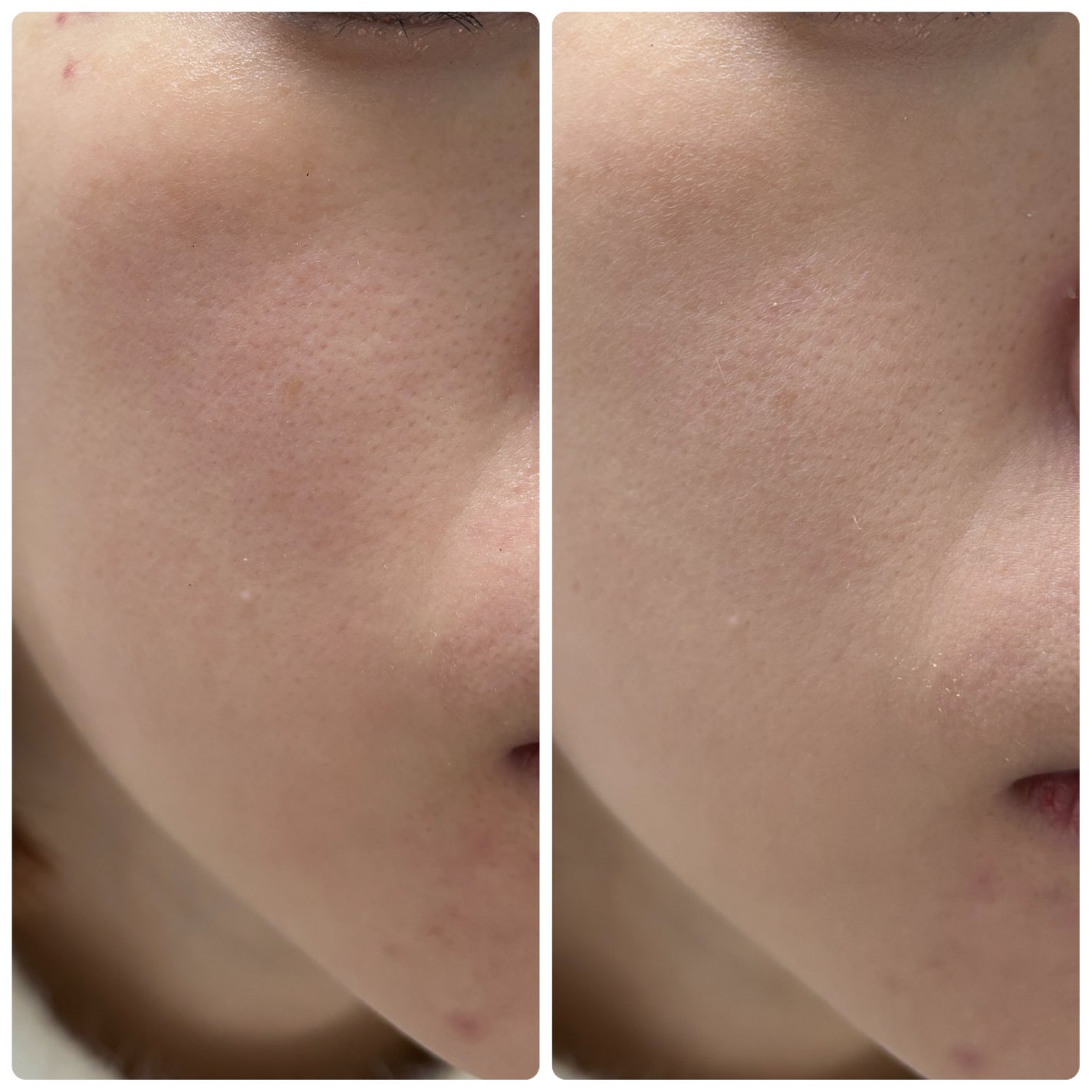 トランシーノ薬用UVパウダーEX/トランシーノ/日焼け止めパウダーを使ったクチコミ(6枚目)