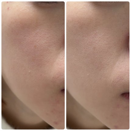 トランシーノ薬用UVパウダーEX/トランシーノ/日焼け止めパウダーを使ったクチコミ(6枚目)