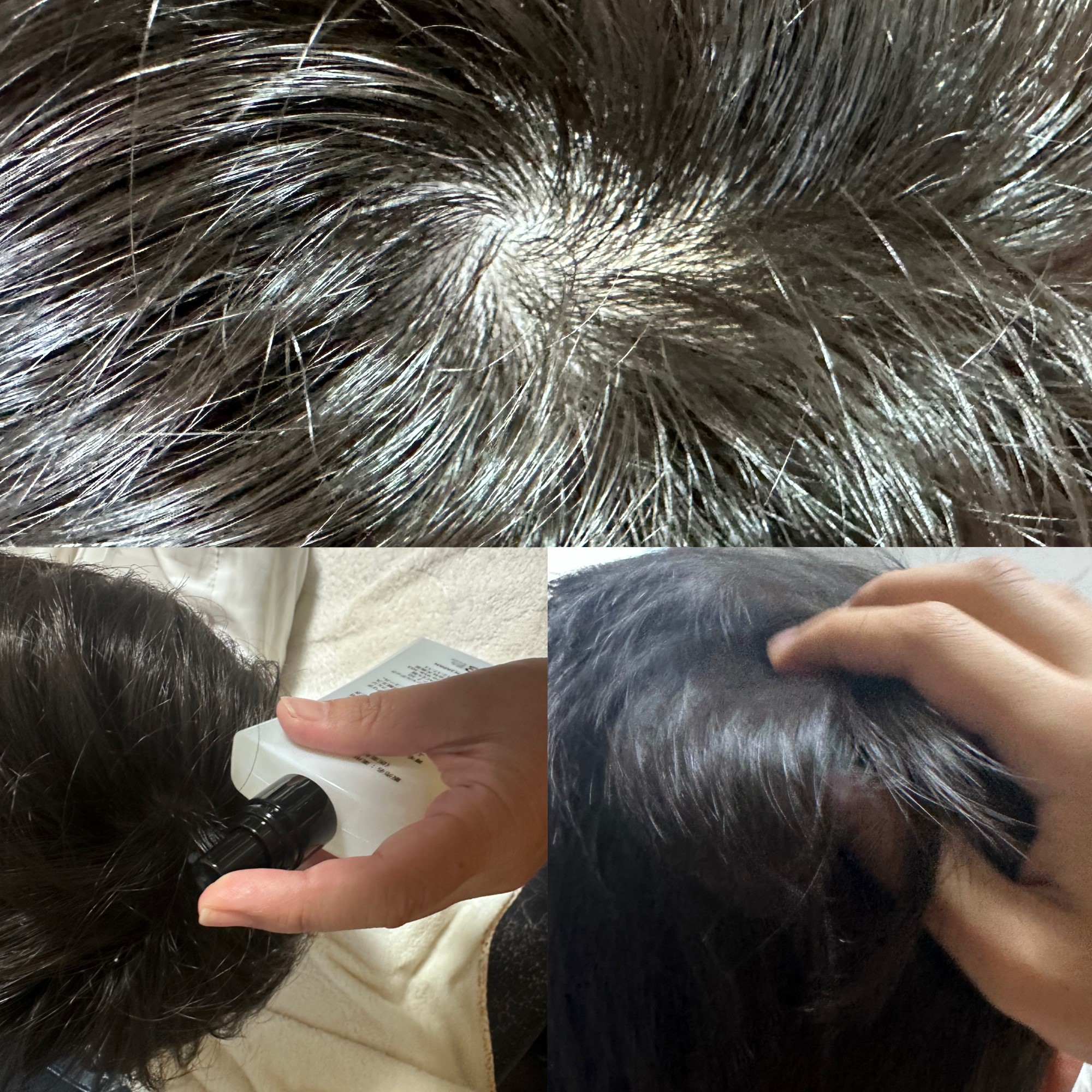 チャップアップ育毛ローション/CHAP UP(チャップアップ)/頭皮ローションを使ったクチコミ（2枚目）