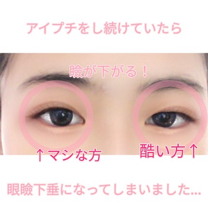 アイトーク スーパーホールド/アイトーク/二重まぶた用アイテムを使ったクチコミ(2枚目)