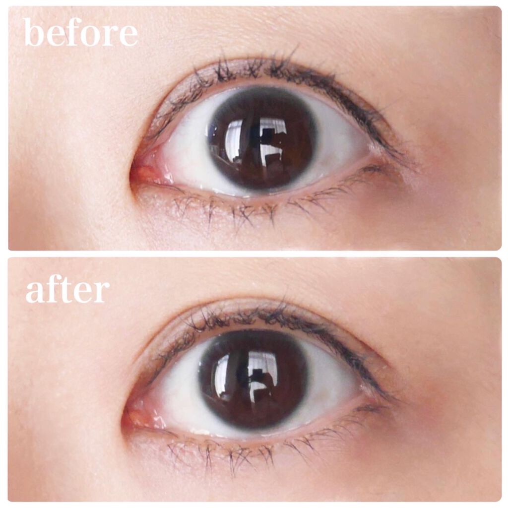 2Wayアイテープ/Eye Catching Beauty/二重まぶた用アイテムを使ったクチコミ(4枚目)