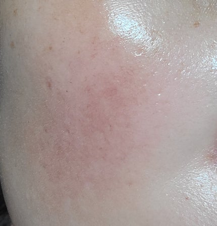 レチノール スーパーバウンス セラム/IOPE/美容液を使ったクチコミ(4枚目)